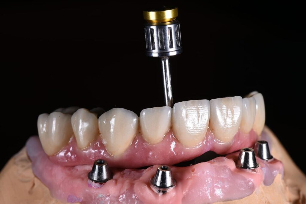 First dentures