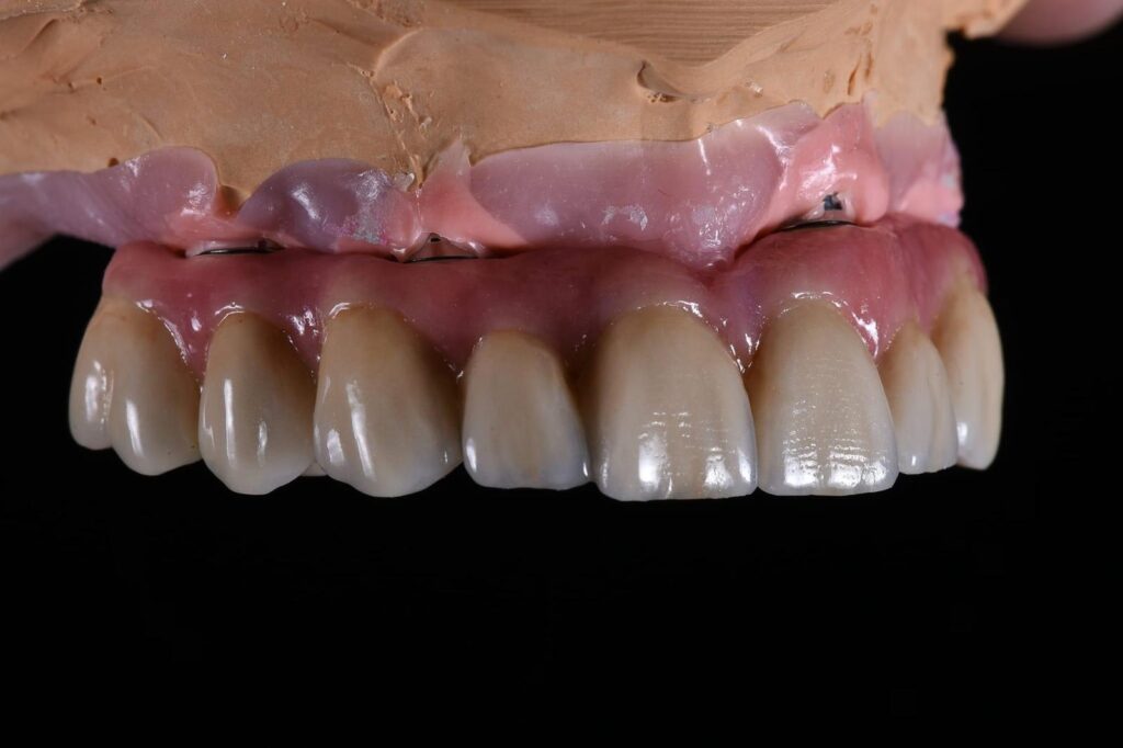 Denture care