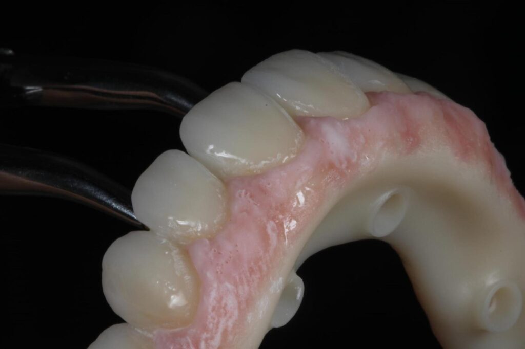 Denture adjustments