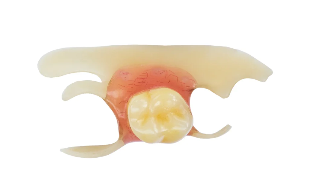single tooth denture artificial wolverhampton